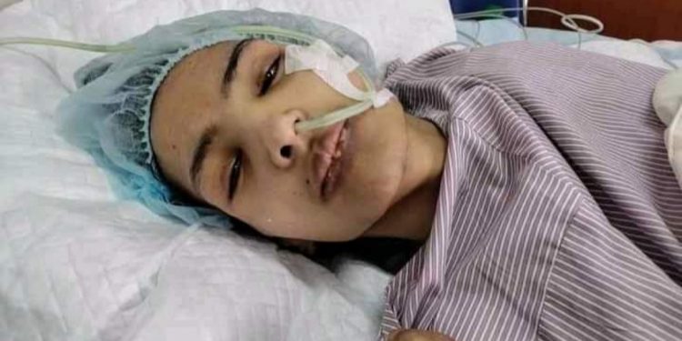 उपचारपछि मोडल निशा घिमिरेको अनुहारमा देखियाे यस्तो चमक !