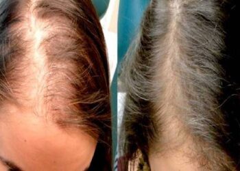 नखानुहोस् यस्ता खाना, नत्र छिट्टै खुइल्याउँछ तपाईको तालु