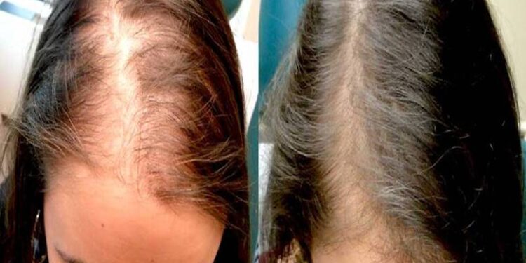 नखानुहोस् यस्ता खाना, नत्र छिट्टै खुइल्याउँछ तपाईको तालु