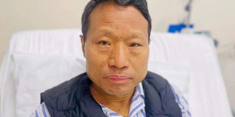 माओवादी नेता बर्षामान पुनकाे कलेजो प्रत्यारोपण गरिने